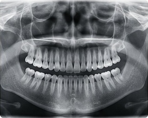 Exemplo de radiografia panorâmica